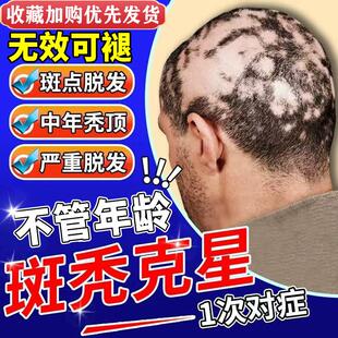 鬼剃头药斑秃生发液儿童斑秃成块掉秃头地中海增发密发快速生发液