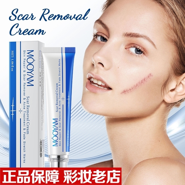 Scar repairing removing疤痕滋润修护面霜 Scar cream