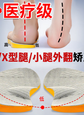 鞋垫外八字膝盖内扣外翻矫正器