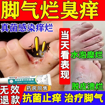 脚气止痒脱皮杀菌真菌感染云南本草臭脚出汗特效专用根去药喷雾剂