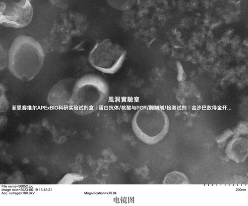 umibio®外泌体提取试剂盒(尿液) 适用尿液,可提取50ml/500ml尿液