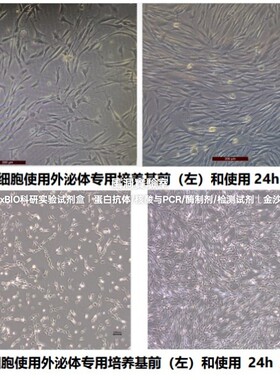 umibio®外泌体专用间充质干细胞培养基-含酚红无酚红,外泌体培养