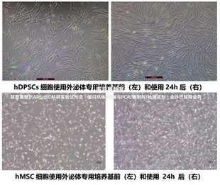 umibio®外泌体专用间充质干细胞培养基-含酚红无酚红,外泌体培养