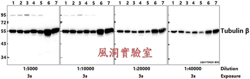 内参抗体Bioworld微管蛋白-β多克隆抗体/单克隆抗体WB/IP/IHC/IF