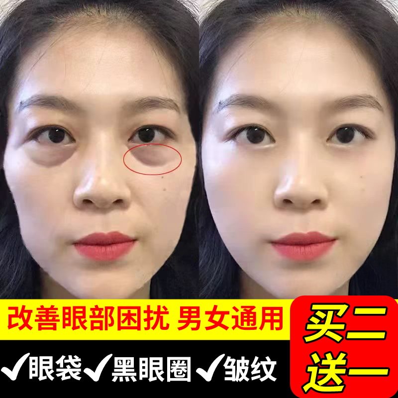 眼霜淡化黑眼圈细纹眼袋鱼子酱冻龄修复抗皱男女去提拉紧致除神器