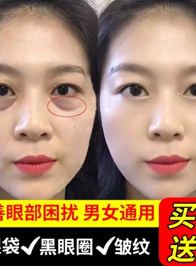 眼霜淡化黑眼圈细纹眼袋鱼子酱冻龄修复抗皱男女去提拉紧致除神器