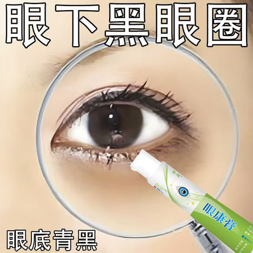 黑眼圈专用眼膏去除黑色素沉淀男女熬夜眼袋黑眼圈眼膜舒缓疲劳o