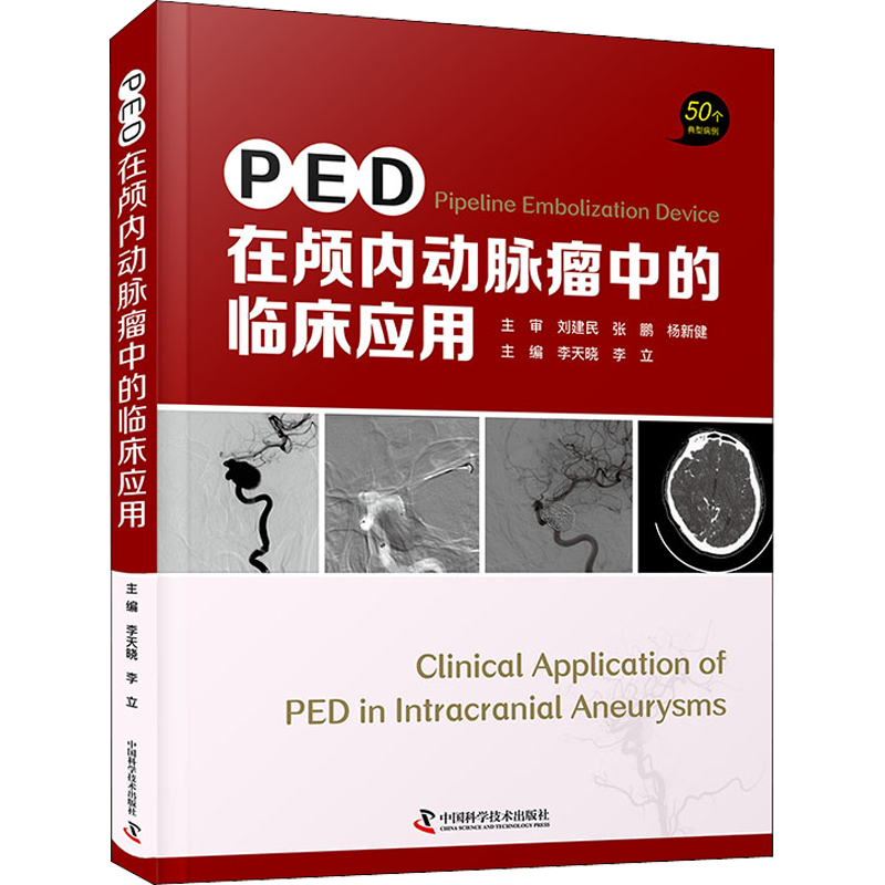PED在颅内动脉瘤中的临床应用 李天晓,李立 编 妇产科妇科疾病诊断治疗技法教程图书 医学参考资料书籍 中国科学技术出版