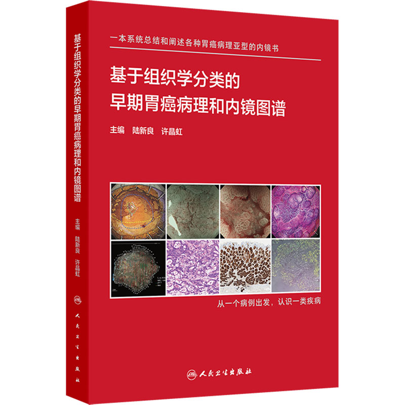 基于组织学分类的早期胃癌病理和内镜图谱 陆新良,许晶虹 编 医学外科学医师资料专业书籍 人民卫生出版