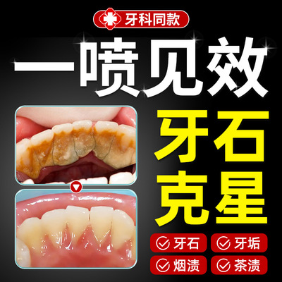 韩国首尔牙结石溶解护龈固齿清新