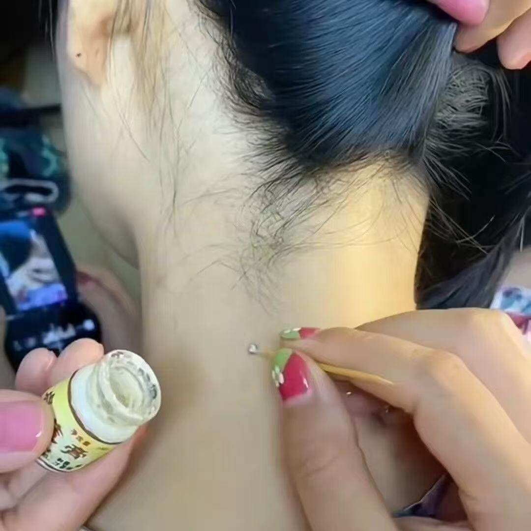 【济苑堂】点黑痣膏无痕脸部点去黑痣专用典痣黑点去痣