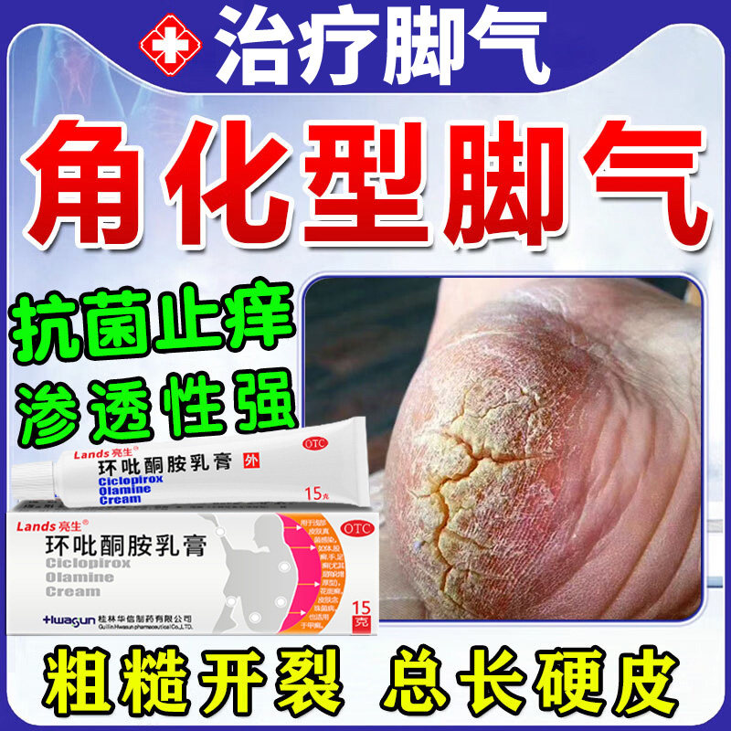 角化型脚气专用药膏真菌感染脚后跟起硬皮足跟干裂止痒脱皮杀菌NN