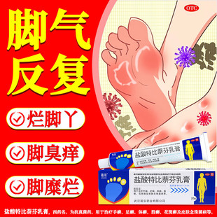 盐酸特比萘芬乳膏正品 去脚气药止痒脱皮杀菌脚痒烂脚丫真菌感染NN