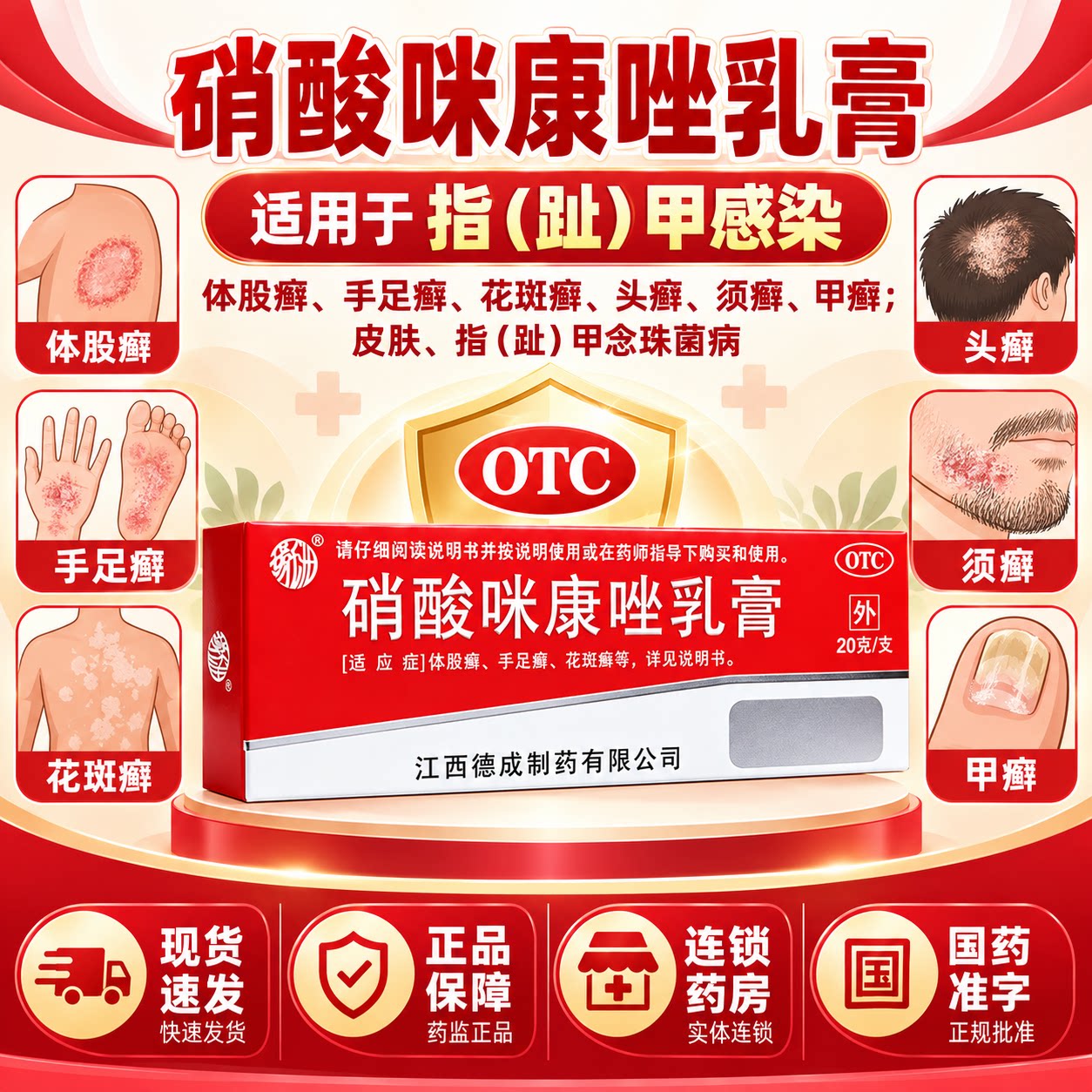 硝酸咪康唑乳膏指趾甲感染体股癣手足癣花斑癣头癣甲癣真菌感染NN图片