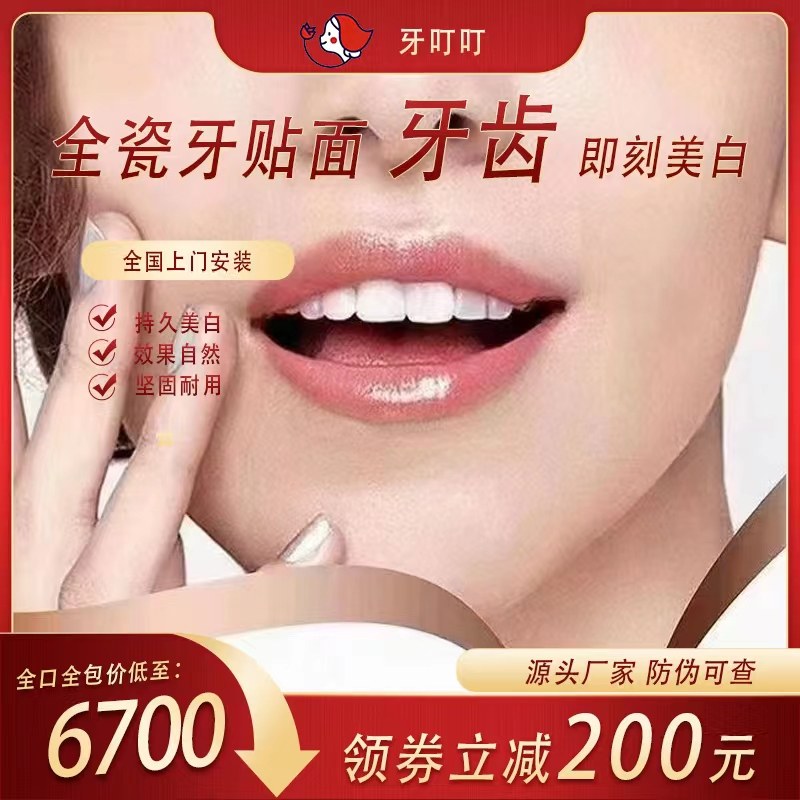 义获嘉全瓷贴面镶牙超薄超硬自然遮瑕修复美白蓝瓷牙齿贴片 全口