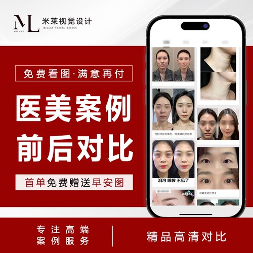医美前后案例对比设计效果图朋友圈美业轻医美前后对比最新款