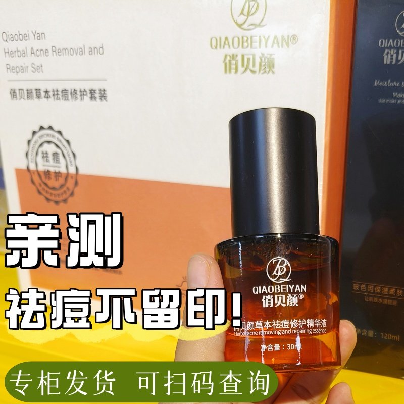 俏贝颜草本祛痘精华液修护保湿清爽青春痘闭口粉刺祛痘霜膏正品,美容护肤/美体/精油,面部护理套装,淘宝优惠券,粉丝福利购,淘宝优惠卷