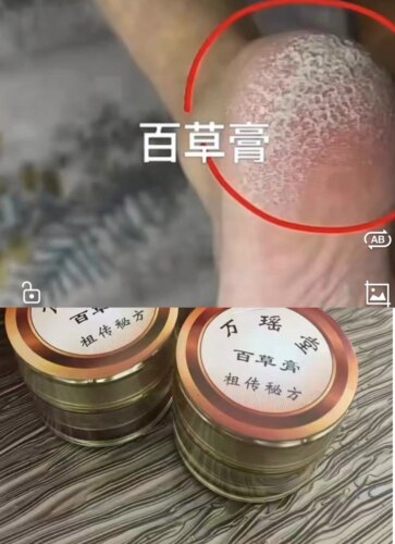 万瑶堂百草膏特效秘方配方