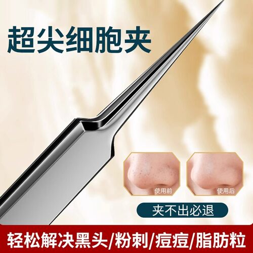 细胞夹粉刺针细胞夹套装净痘工具去黑头镊子神器挑痘痘适用工具