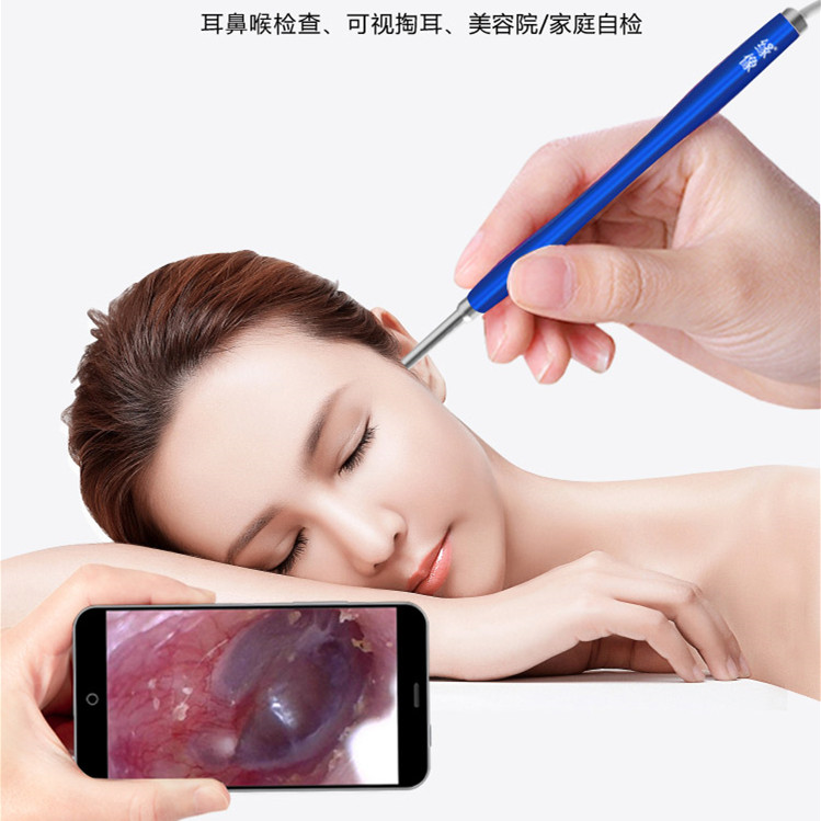 耳科赵医生独家授权:3.9mm有线可视定向耳内镜