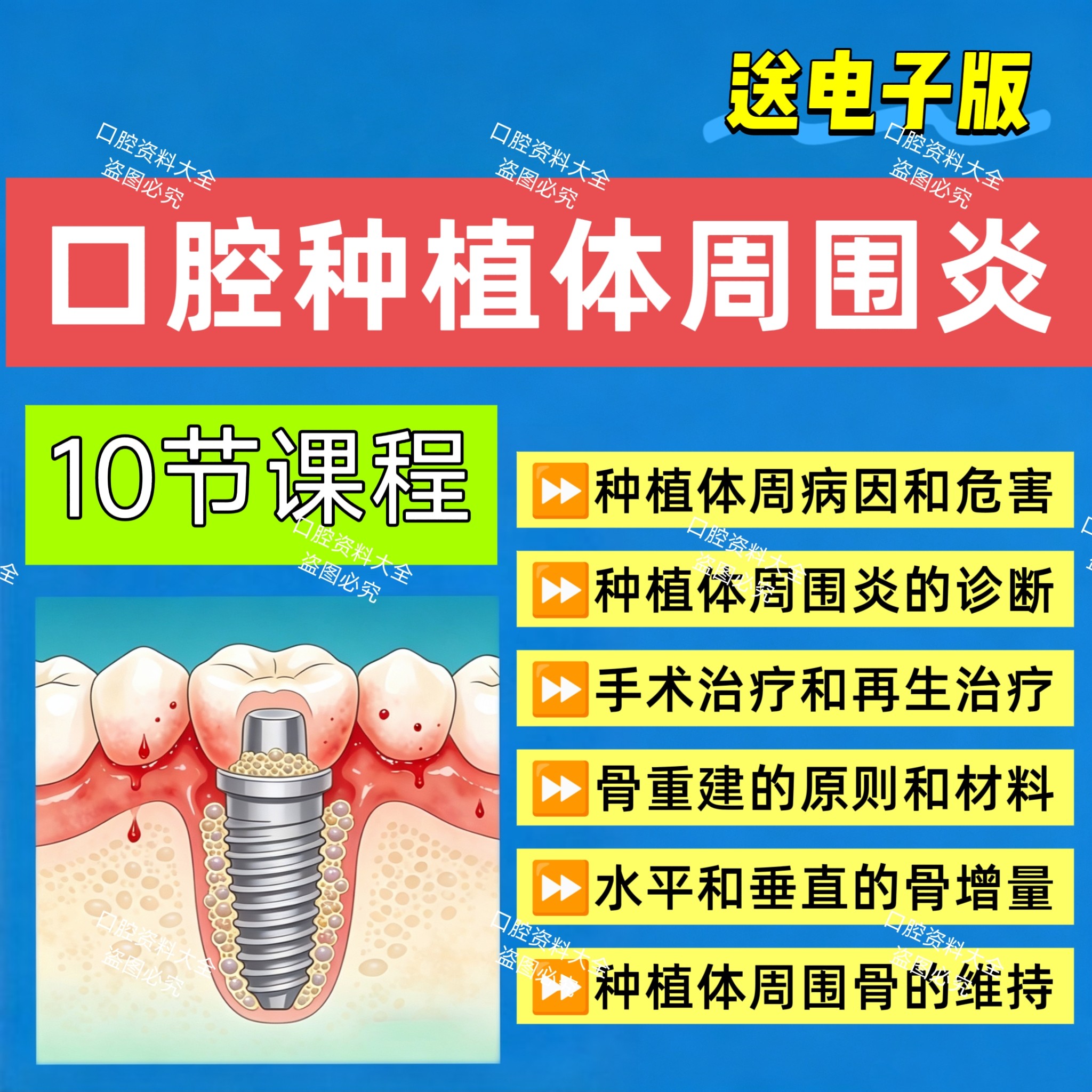 口腔种植体周围炎视频课程垂直骨增量水平骨增量课程理论实操