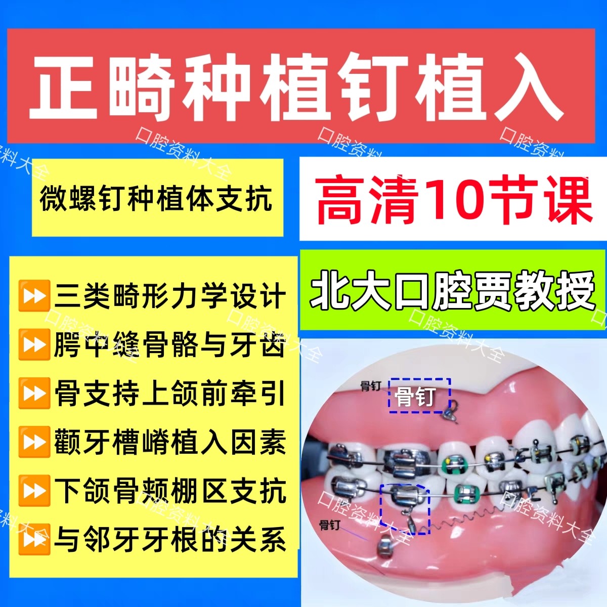 正畸种植钉植入正畸支抗钉设计支抗钉多种病例正畸视频课程