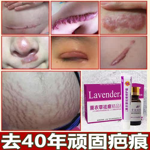 [喜阳春实业淡疤护理]祛 疤痕组合祛 疤膏淡化妊娠纹修复剖月销量0件仅售58元