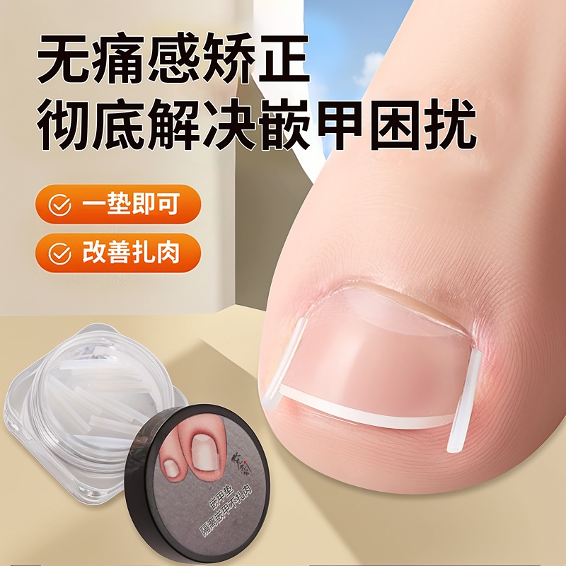 甲沟矫正器填充垫片防脚指甲