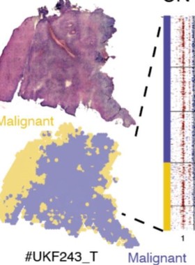 空间转录组分析空转分析spatial10xgenomics空转联合单细胞ST分析