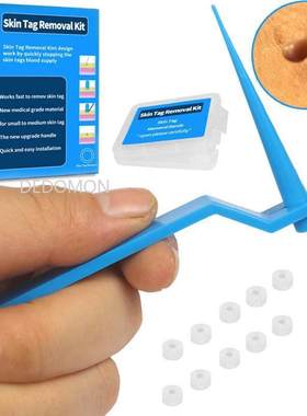 Blue Set Skin Tag Removal Kit Home Use Mole Wart Remover