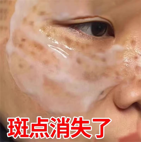 无效包退美白去黑一抹祛斑