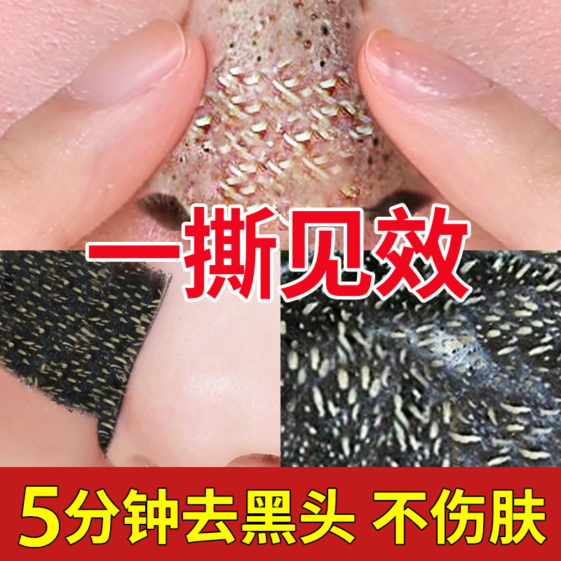 去黑头收缩毛孔套装吸黑头神器男鼻贴