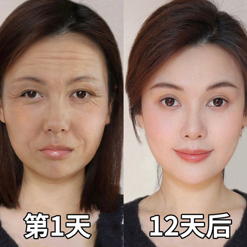 【无效包退】告别全脸皱纹