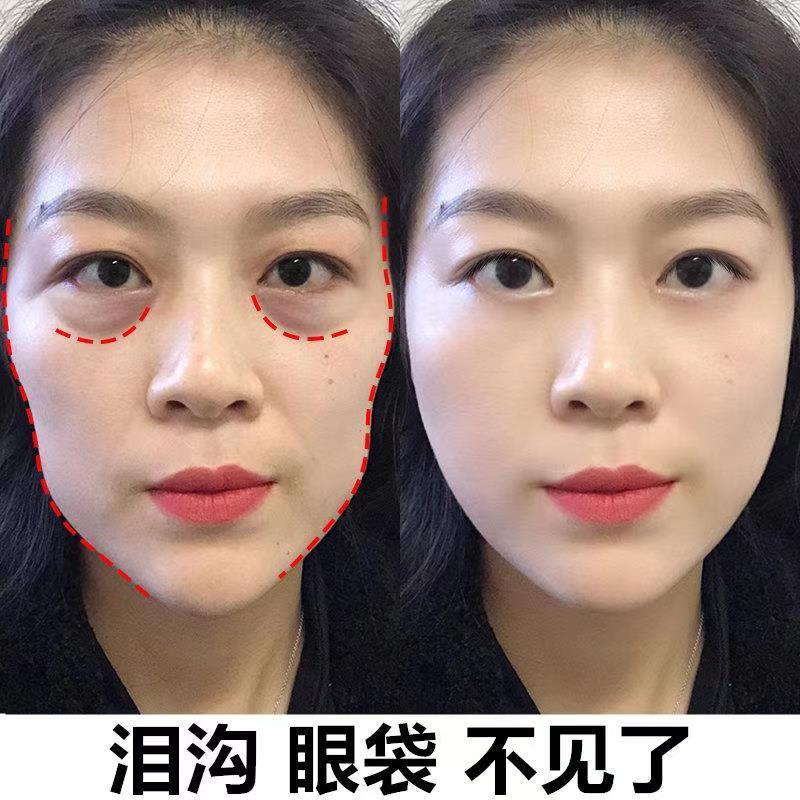 【小红书推荐】跟黑眼圈泪沟说拜拜 收缩眼袋提拉眼部男女通用