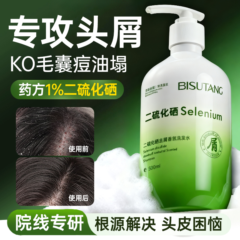 二硫化硒去屑洗发水液头皮毛囊清洁止痒洗头控油蓬松膏炎持久留香