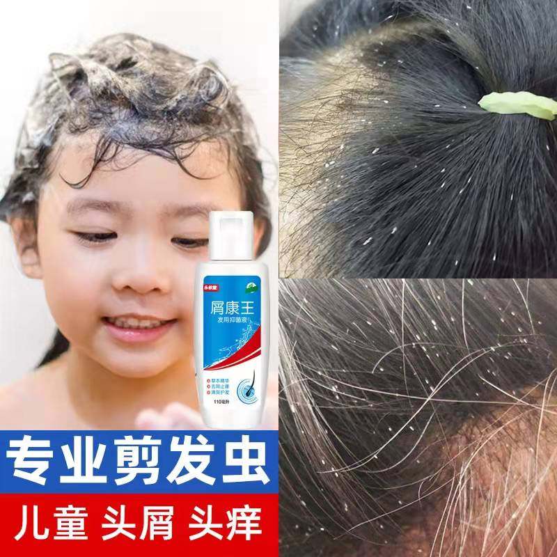 儿童专用剪发虫洗发水正品康王去屑止痒去卷发虫吃发虫除螨洗发水
