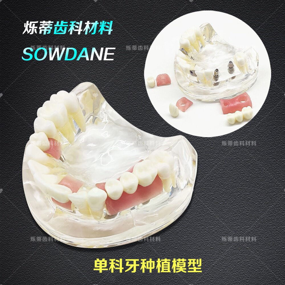 牙齿模型口腔教学正畸种植修复模型可拆卸假牙备牙模型雕石膏牙科