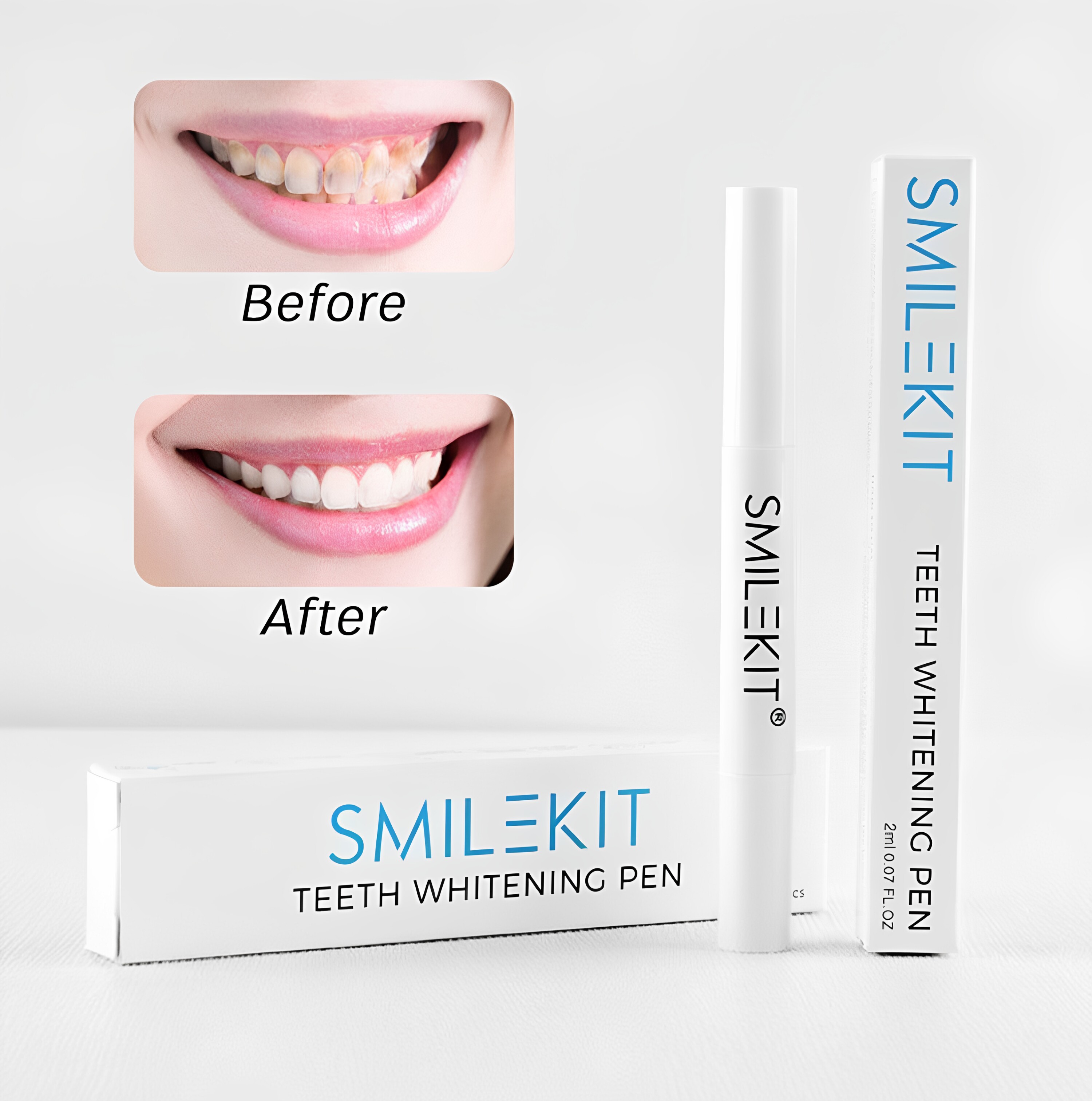 smilekit 美白牙齿笔美白牙齿凝胶光泽笔2ml去渍去黄提亮美白脱色
