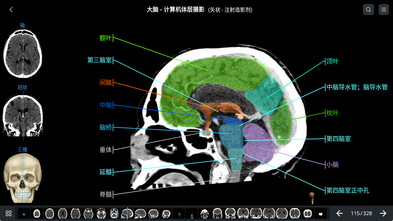 e-Anatomy解剖图集中文永久win安卓mac都能eanatomy（医生优惠）