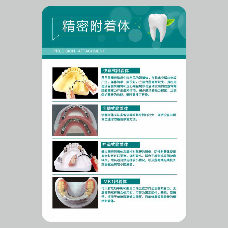 亚克力精密附着体烤瓷牙龋齿的发展口腔医院海报牙科诊所挂图定制
