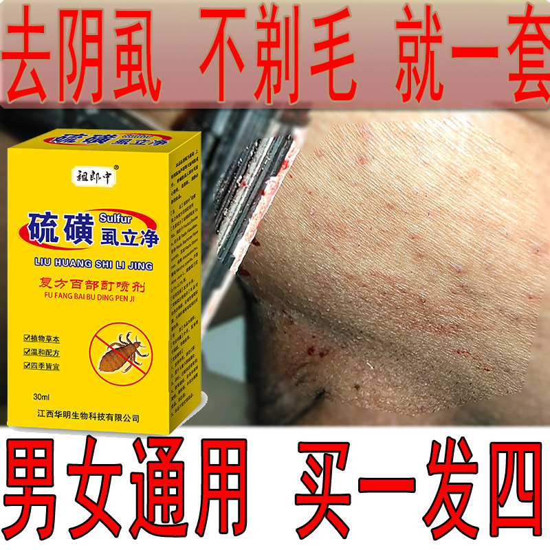 虱子药男士女私处去除阴虱一扫光百部酊灭虱立净喷雾正品硫磺软膏