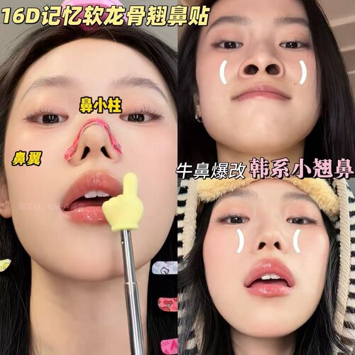 可调节软龙骨翘鼻贴缩小鼻翼