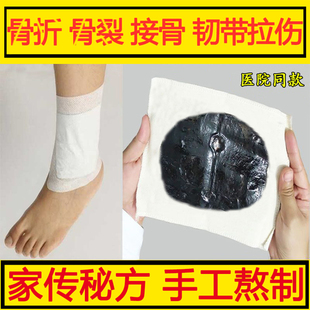 古方熬制骨断折骨裂恢复药膏贴快速接骨膏药跌打损伤贴脚踝愈合药