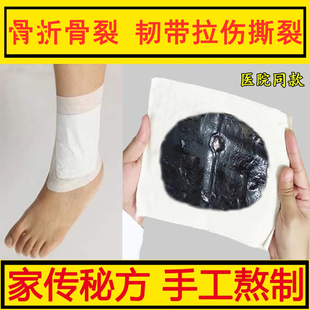 陈旧骨折伤筋骨裂恢复药膏快速接骨膏韧带拉伤跌打脚踝崴伤愈合药