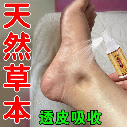 【苗王正品】脚水肿消肿专用药