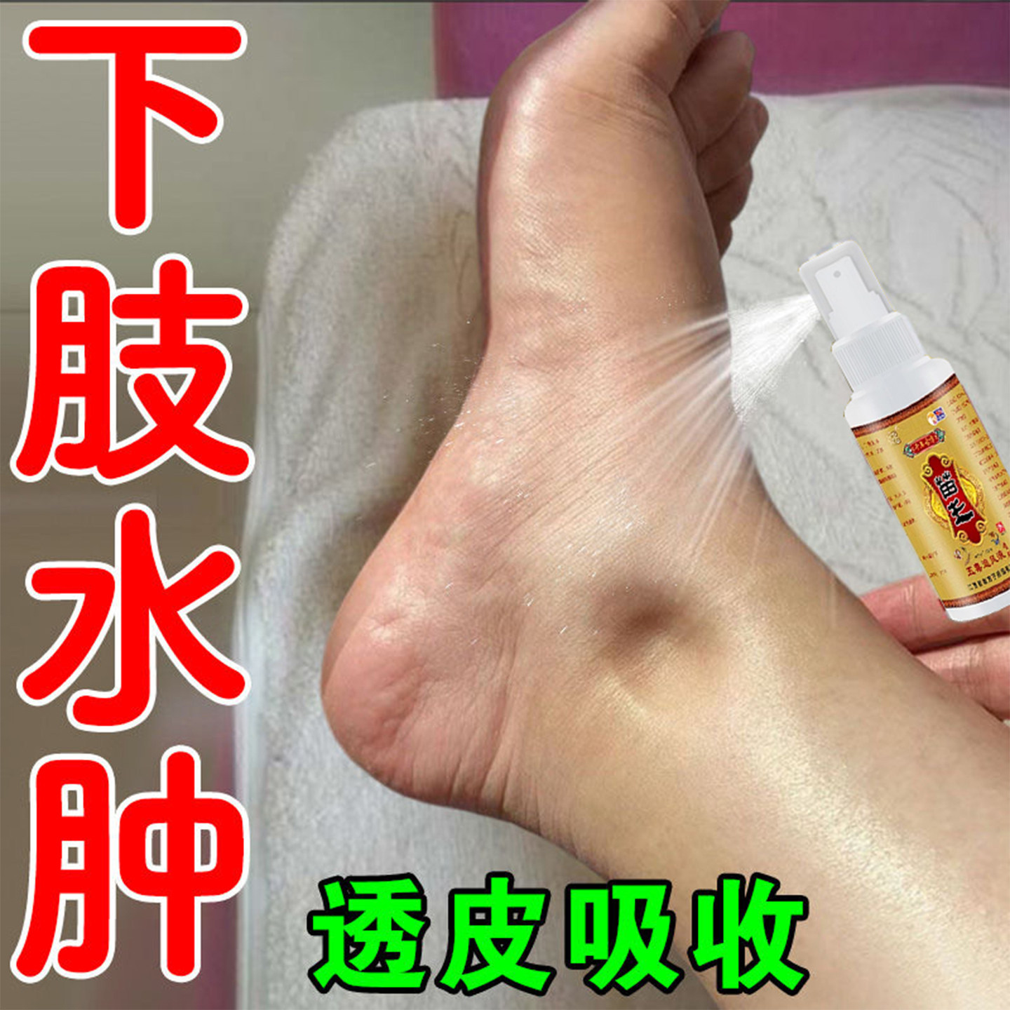【苗王】脚肿消去肿的药脚踝扭伤水肿专用药活络化瘀跌打损伤神器