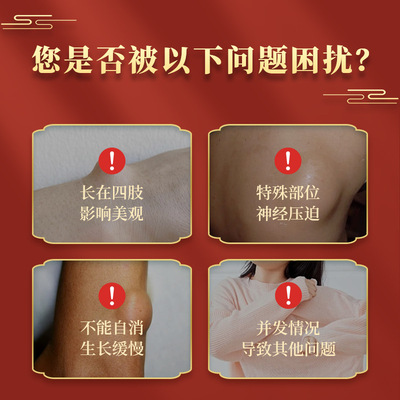 脂肪康贴 厂家现货脂肪包块贴膏脂肪康膏全身多发性皮下脂肪消贴