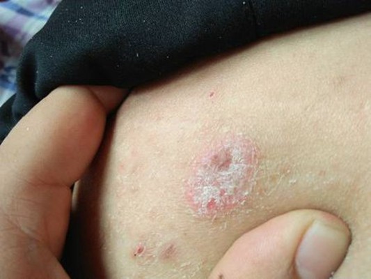 卢老头草本乳膏正品 皮肤护理膏 买2送1 卖4送2 福利多多,洗护清洁剂/卫生巾/纸/香薰,身体乳液,淘宝优惠券,粉丝福利购,淘宝优惠卷