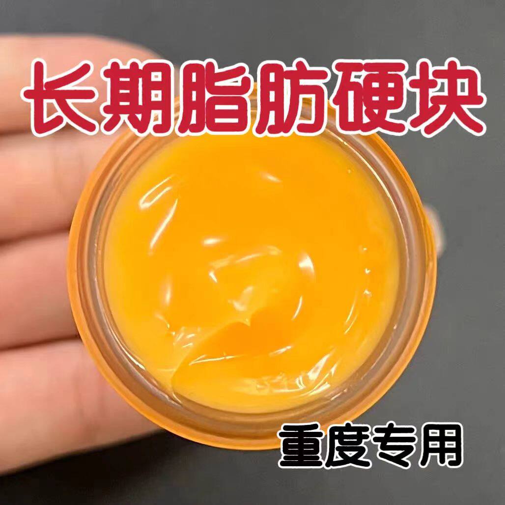 正品脂肪康肿块膏瘤膏皮下硬块单发性多发性涂抹膏