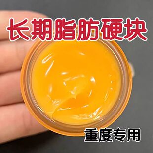 正品脂肪康肿块膏瘤膏皮下硬块单发性多发性涂抹膏